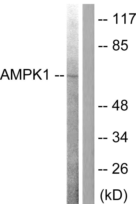 PRKAA1 + PRKAA2 Antibody (aa140-189)