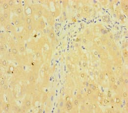 Polyclonal Rabbit anti-Human TMPRSS11B Antibody
