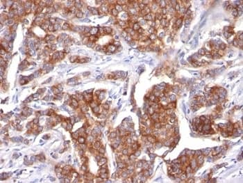 KRT18 / CK18 / Cytokeratin 18 Antibody (clone KRT18/834)