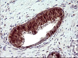 SERPINB3 Antibody (clone OTI2B11)