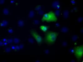Monoclonal Mouse anti-Human ALDH3A1 Antibody (clone OTI1C6, IHC, IF, WB)