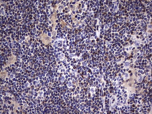BCL2 / Bcl-2 Antibody (clone OTI2E5)