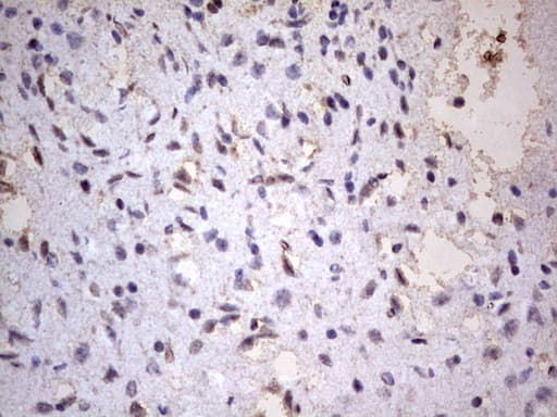 Monoclonal Mouse anti-Human CD63 Antibody (clone OTI1F10, IHC)
