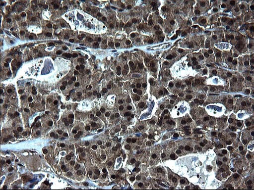 ZFAND3 / TEX27 Antibody (clone OTI1H9)