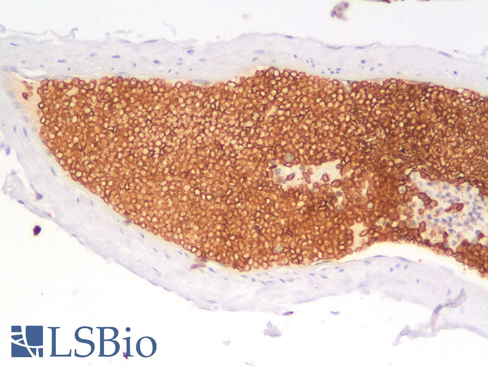 PathPlus™ Recombinant Monoclonal Rabbit anti-Human GYPA / CD235a / Glycophorin A Antibody (clone GYPA/1725R, IHC)