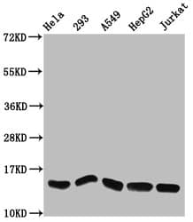 Polyclonal Rabbit anti-Human HIST1H2AI Antibody (IHC, WB)