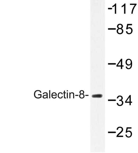 LGALS8 / Galectin 8 Antibody (Asn82)