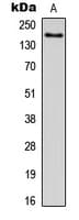 ADGRL1 / LPHN1 Antibody (Internal)