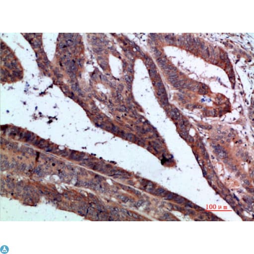 Polyclonal Rabbit anti-Human IL37 Antibody (IHC)