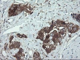 TSC22D1 / TSC22 Antibody (clone OTI3B10)