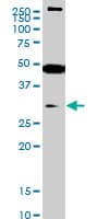IHC-plus™ Monoclonal Mouse anti-Human SETD7 / SET7 Antibody (clone 5B4, IHC, IF, WB)