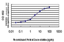 PathPlus™ FOXA2 Antibody (clone 1C7)