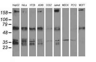 IGF2BP2 Antibody (clone OTI2H7)