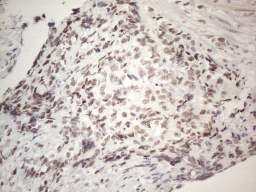 IRS1 Antibody (aa1-280, clone OTI2B10)