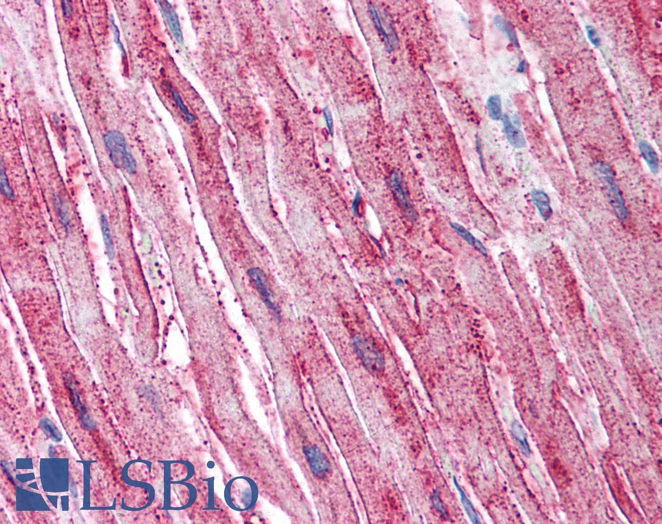 IHC-plus™ ADAMTS4 Antibody (Internal)