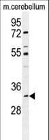 Polyclonal Rabbit anti-Human ALKBH6 Antibody (aa116-145, IHC, WB)