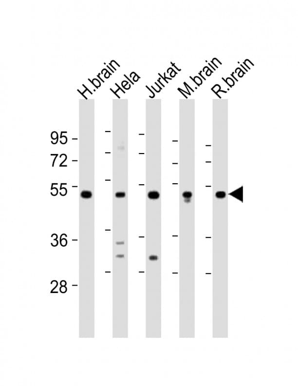 CHST1 Antibody (aa392-426)