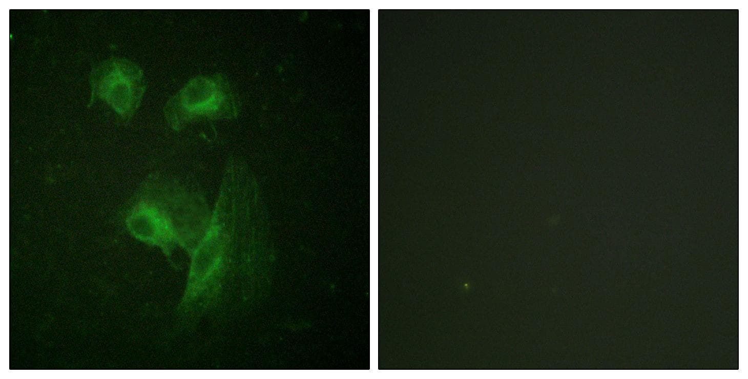 RPS6KB1 / P70S6K / S6K Antibody (p229)