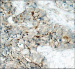 ITGB3 / Integrin Beta 3 / CD61 Antibody
