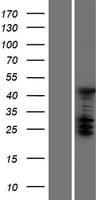 TRIP4 / ASC-1 Protein (Over-Expression Lysate Myc-DDK (Flag))