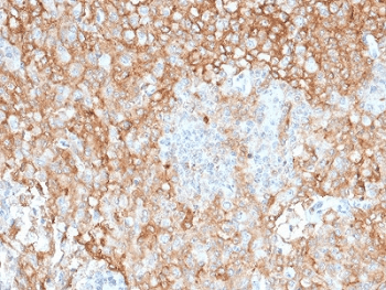 HLA-DRA Antibody (clone TAL 1B5)