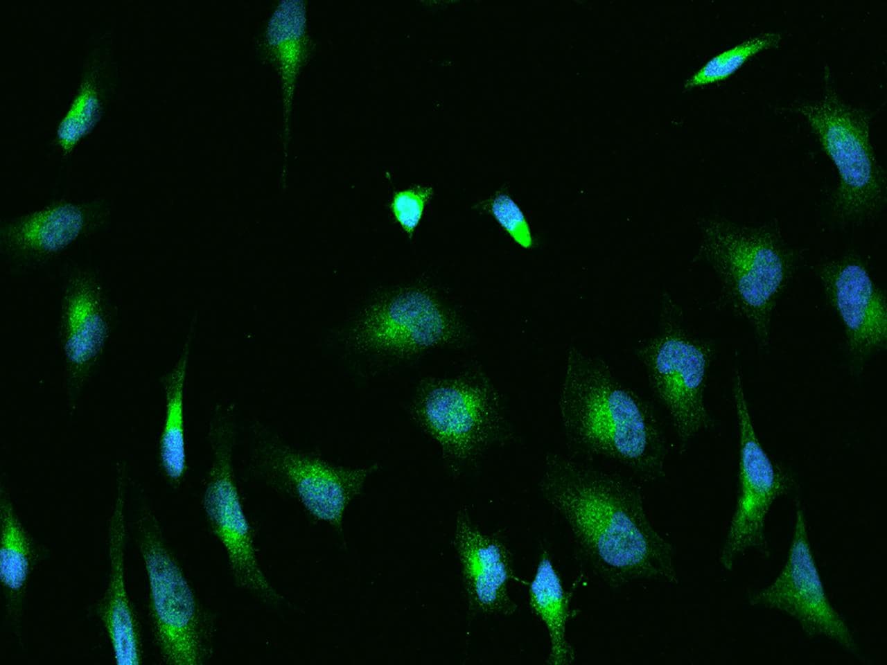 Polyclonal Rabbit anti-Human H6PD / G6PDH Antibody (IHC, IF)