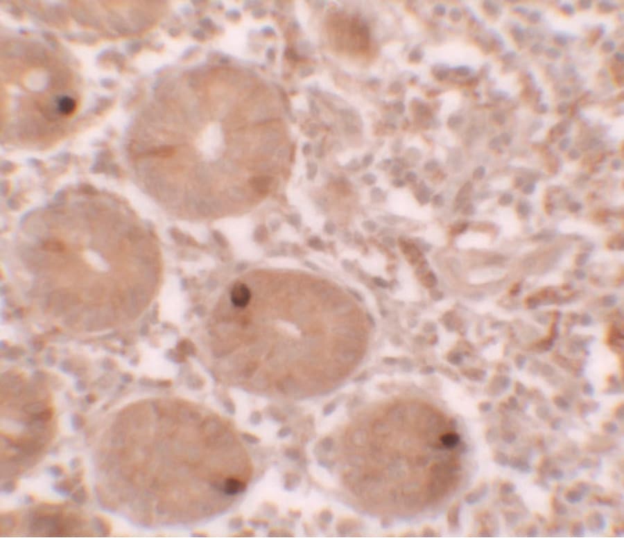 MTERF4 / MTERFD2 Antibody