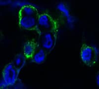 IHC-plus™ Monoclonal Mouse anti-Human EPHB4 / EPH Receptor B4 Antibody (clone 5B5, Extracellular, IHC, IF, WB)