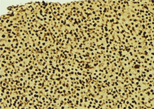 SUMO3 Antibody