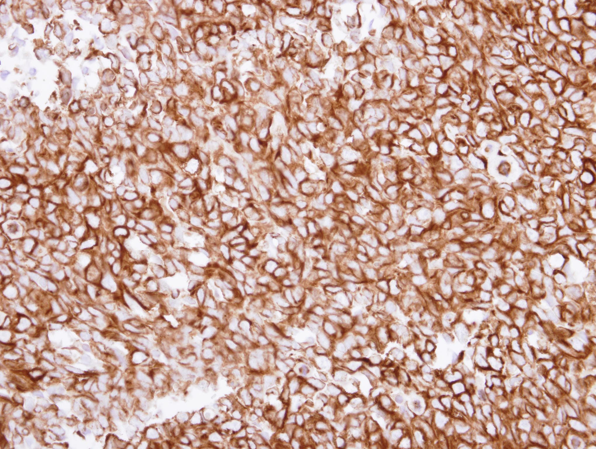 TUBA1A / Tubulin Alpha 1a Antibody (aa227-440)