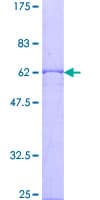 Human CISH / SOCS Protein (Recombinant GST)