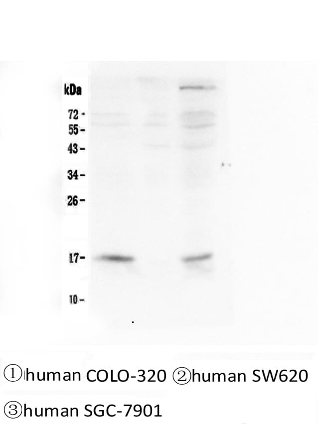 FHIT Antibody