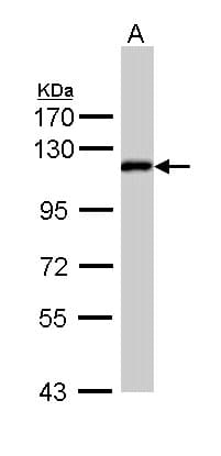 Polyclonal Rabbit anti-Human ZHX2 / RAF Antibody (aa533-826, IHC, WB)