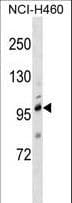 Polyclonal Rabbit anti-Human TRPC1 Antibody (aa765-793, WB)