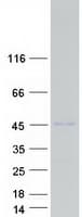 Human CCDC159 Protein (Recombinant Myc-DDK (Flag))