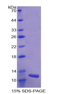 Human GPT2 / ALT2 Protein (Recombinant His)