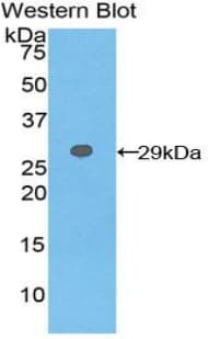GSTT2 Antibody (aa15-235, Biotin)
