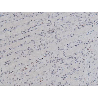 Polyclonal Rabbit anti-Human LYN Antibody (phospho-Tyr508, IHC, IF, WB)