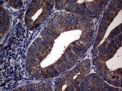 PITPNB Antibody (clone OTI5D11)