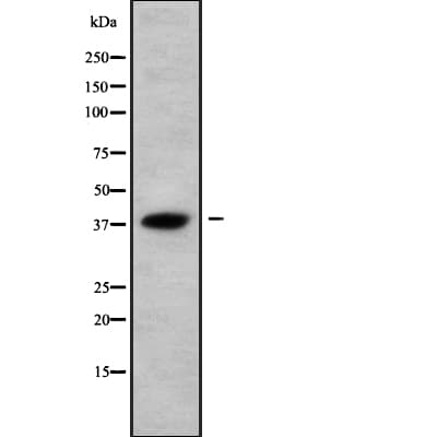 AWAT2 / DGAT2L4 Antibody