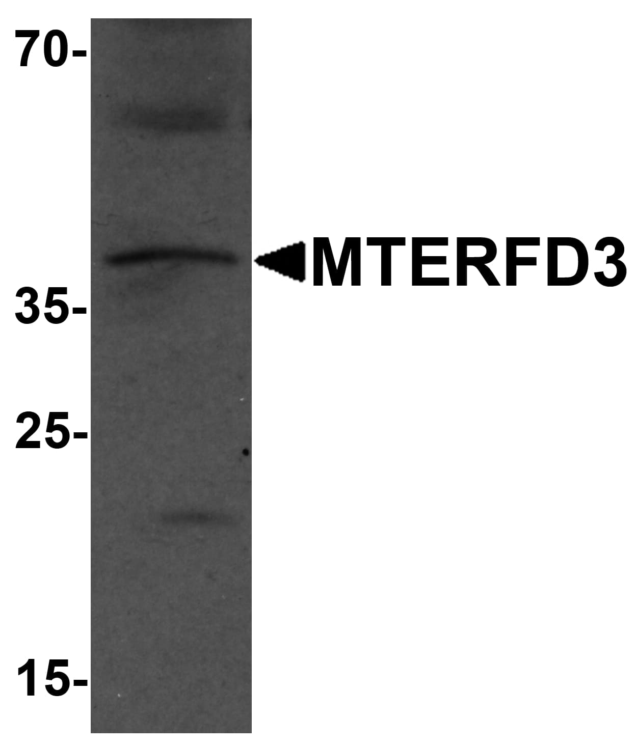 IHC-plus™ MTERF2 / MTERFD3 Antibody