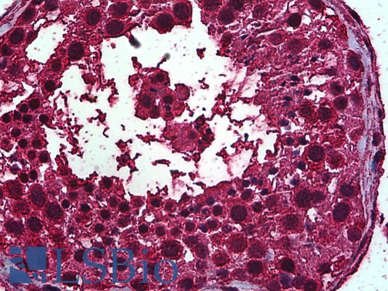 IHC-plus™ RARA / RAR Alpha Antibody (clone 2D2)