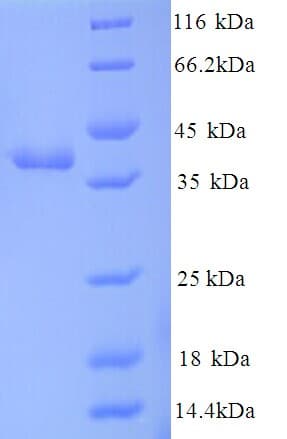 E. coli tsr Protein (Recombinant His)