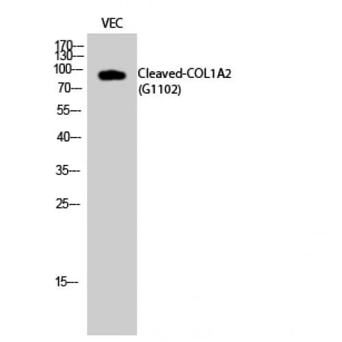Polyclonal Rabbit anti-Human COL1A2 / Collagen I Alpha 2 Antibody (1020-1100 aa, N-terminal, WB)