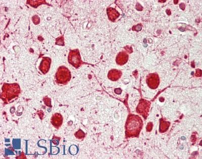 IHC-plus™ RPS14 / Ribosomal Protein S14 Antibody (aa101-151)