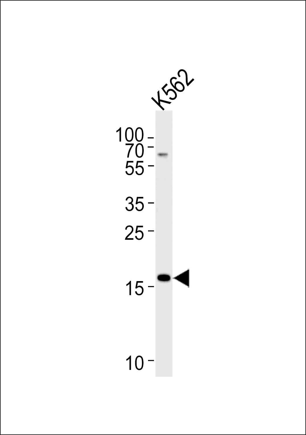 RMA1 / RNF5 Antibody (aa65-94)
