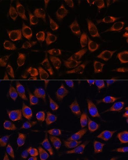 CCDC47 Antibody