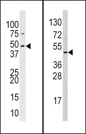 SUV39H2 Antibody (aa360-390)