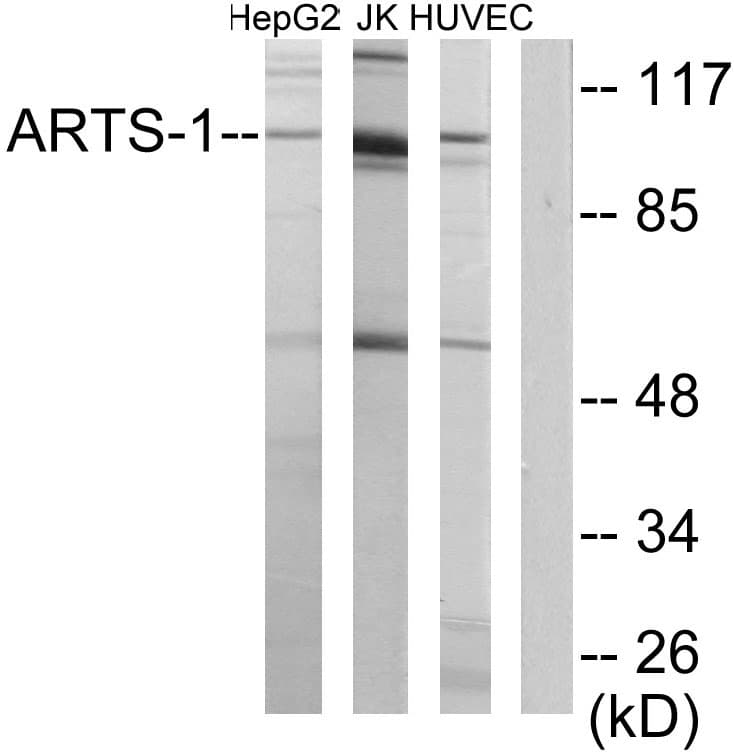 Polyclonal Rabbit anti-Human ARTS1 / ERAP1 Antibody (aa441-490, WB)