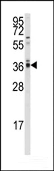 PP2Ac / PPP2CA Antibody (aa1-30)